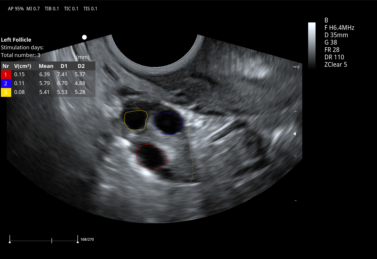 auto Follicle