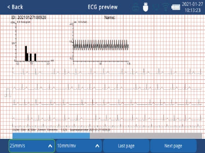 Zoncare iMAC 300 - Aparat EKG + walizka