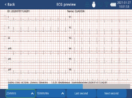 Zoncare iMAC 300 - Aparat EKG + walizka