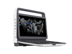 Mobilny aparat USG Zoncare M30 z głowicą liniową i convex