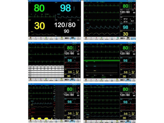 Monitor funkcji życiowych pacjenta PM-7000 D (z wbudowaną drukarką)