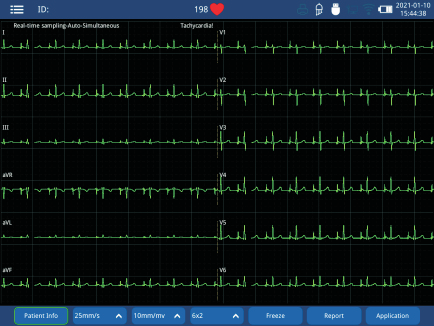 Zoncare iMAC 120 - aparat EKG 